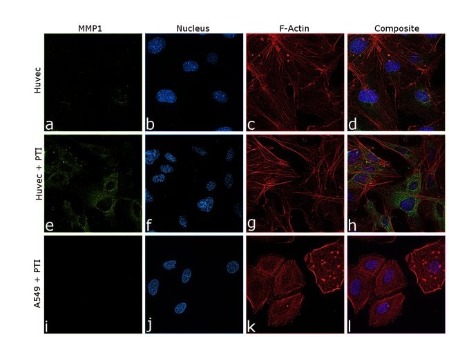 Anti-MMP1