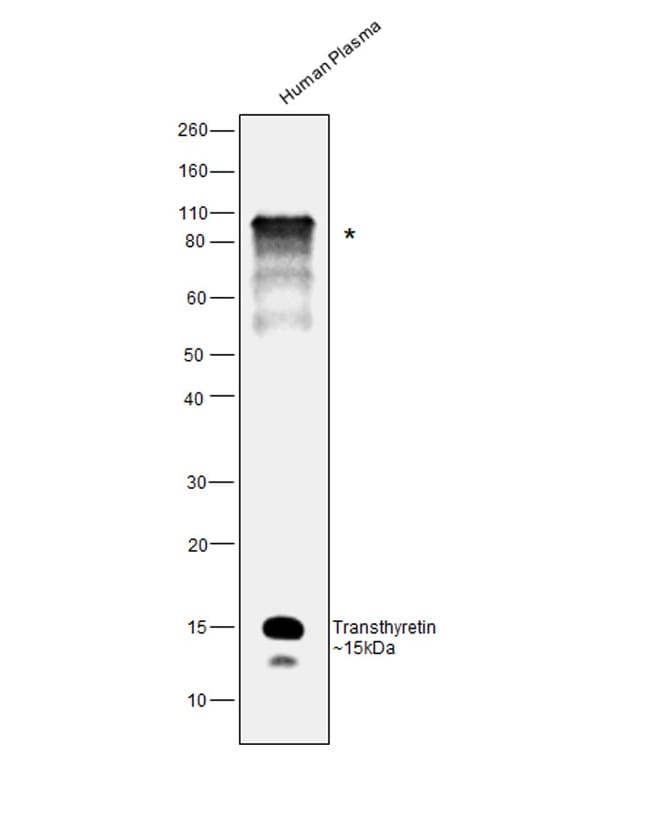 Anti-Transthyretin