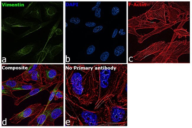 ANTI-VIMENTIN