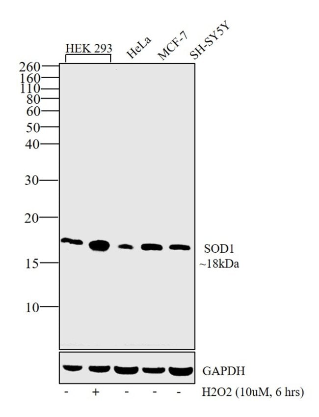 Anti-SOD1
