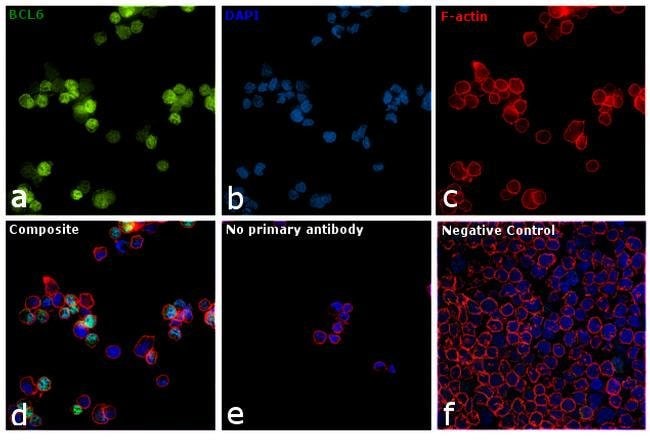 Anti-BCL6