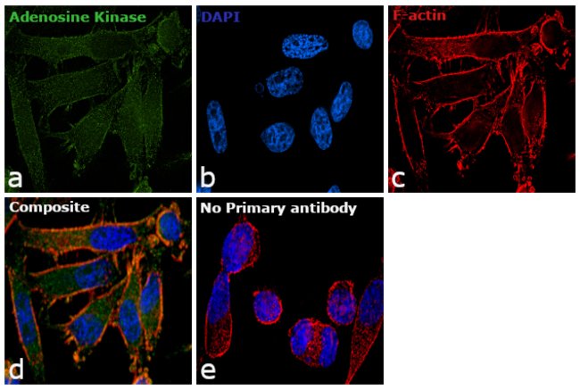 Anti-Adenosine kinase