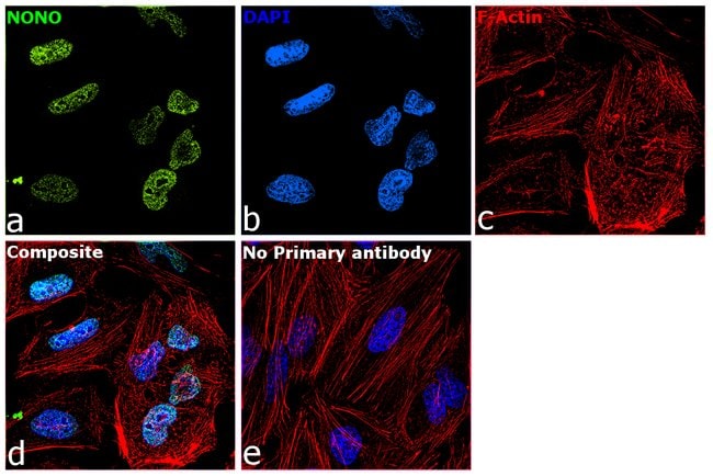 Anti-p54/nrb