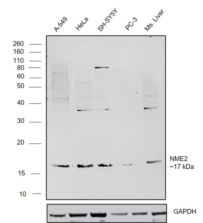 Anti-nm23-H2