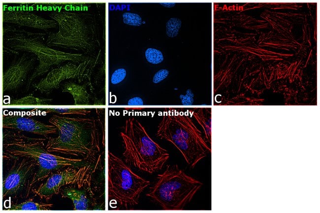 Anti-Ferritin Heavy Chain
