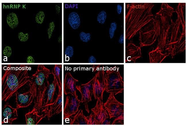 Anti-hnRNP K