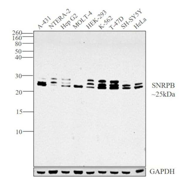 Anti-SNRPB