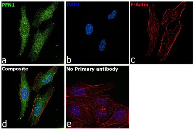 Anti-Profilin 1
