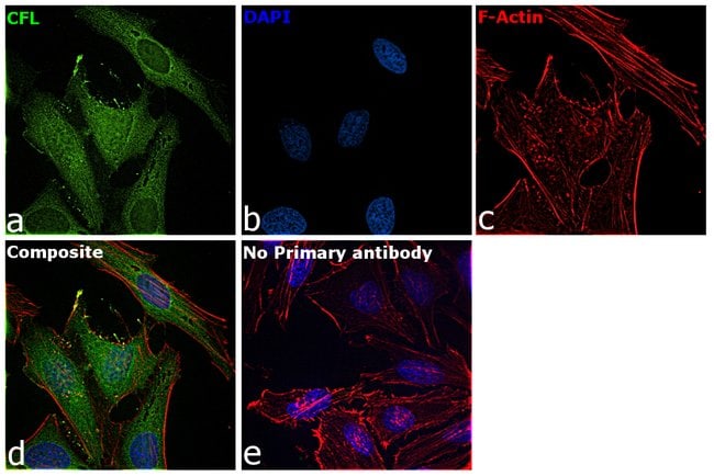 Anti-Cofilin 1 (non-muscle)