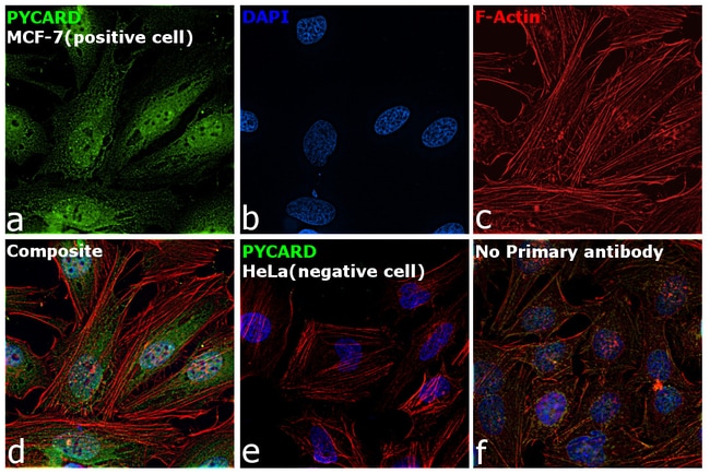 Anti-TMS1