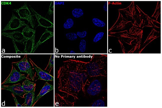 Anti-CDK4