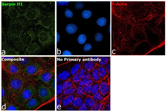 Anti-HSP47