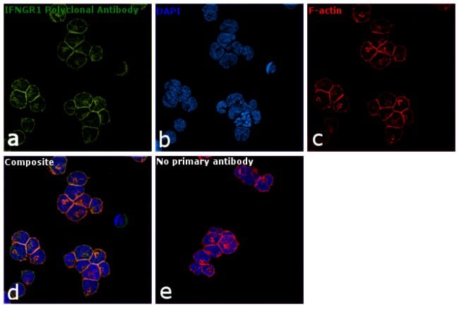 ANTI-INTERFERON GAMMA RECEPTOR 1