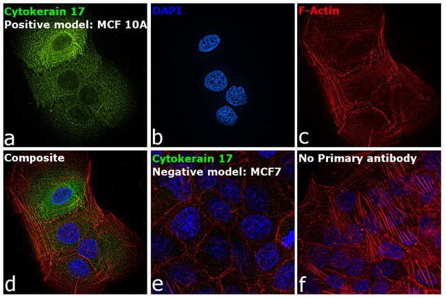 Anti-Cytokeratin 17