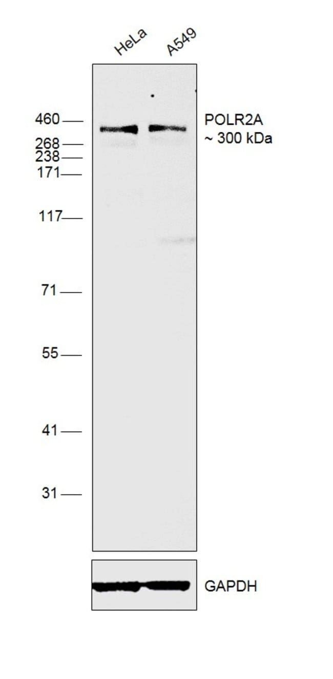 Anti-DNA polymerase IIA