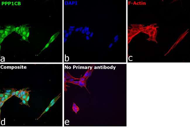 Anti-PPP1CB