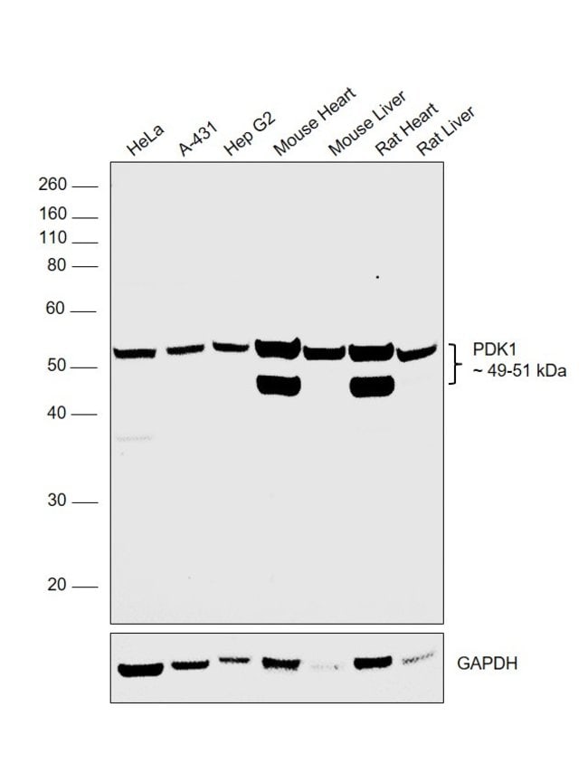 Anti-PDK1