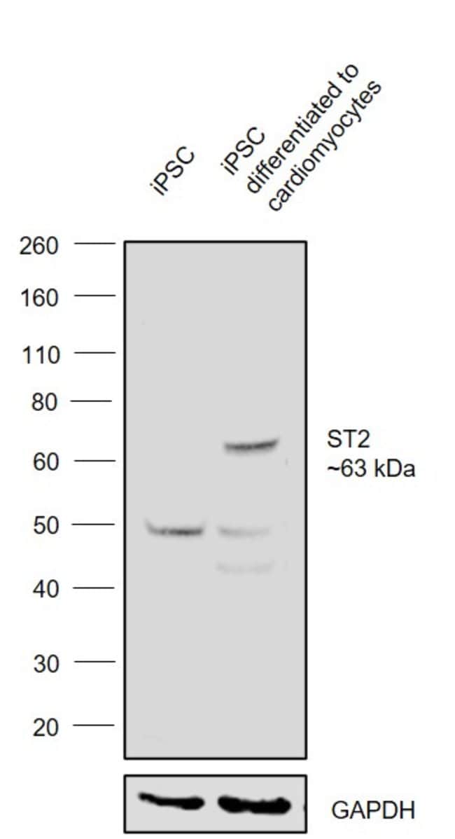 Anti-ST2