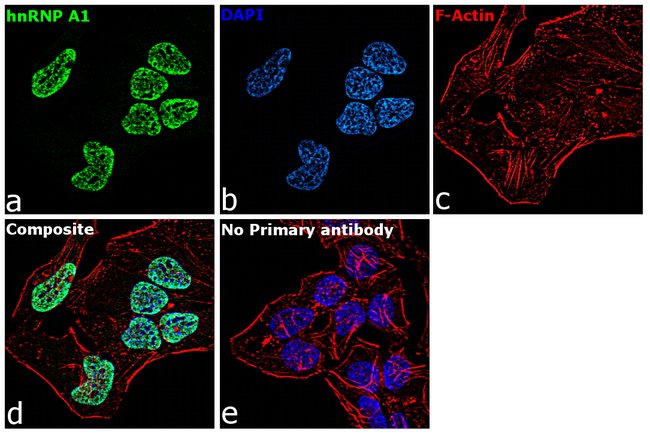 Anti-hnRNP A1
