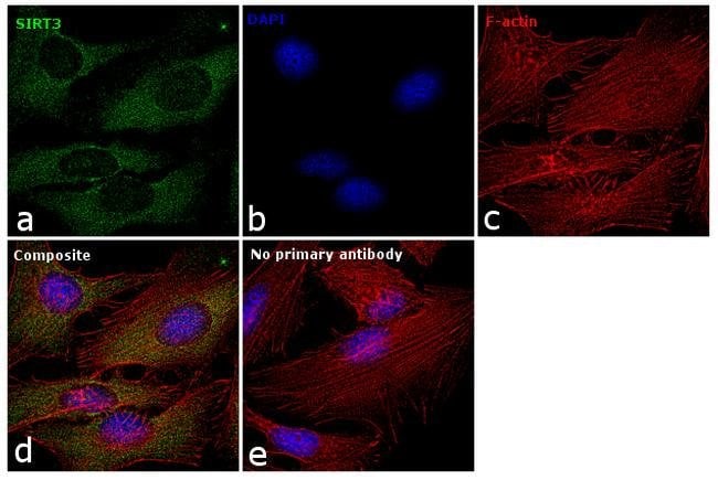 Anti-SIRT3
