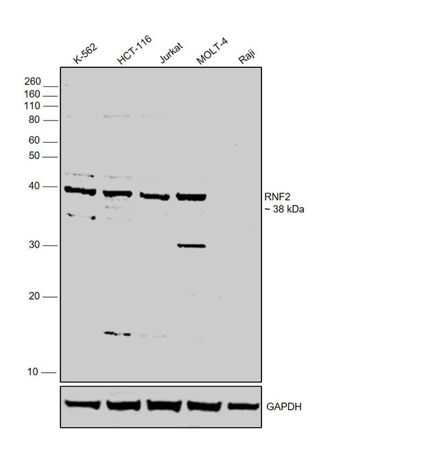 Anti-RNF2