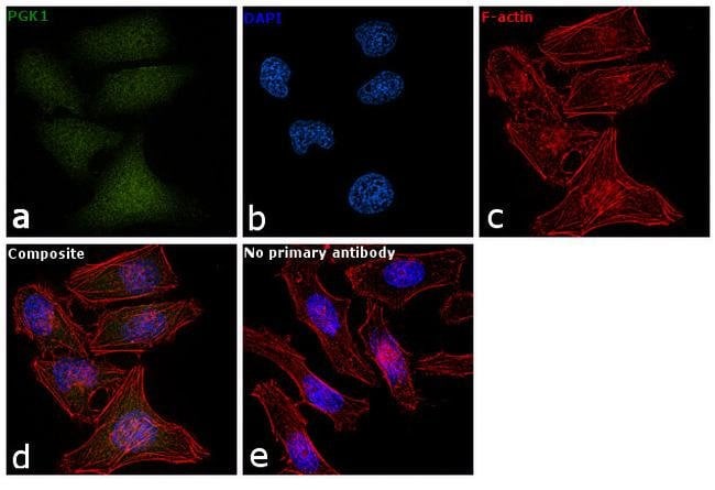 ANTI-PGK1