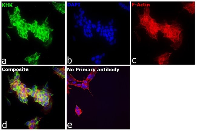 Anti-Ketohexokinase