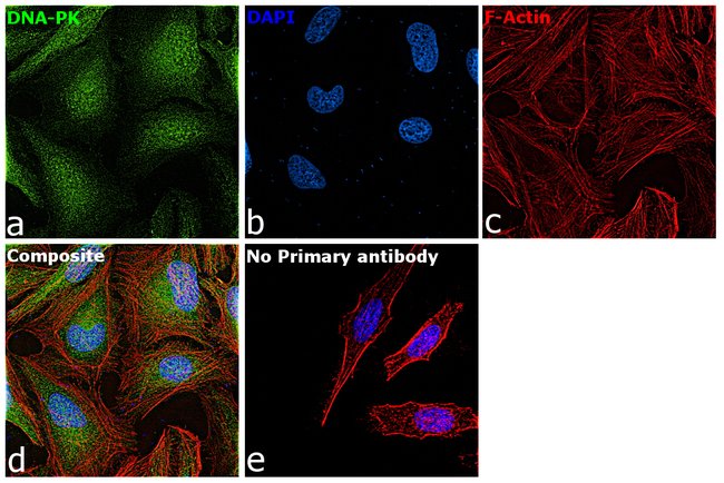 Anti-DNA-PKcs