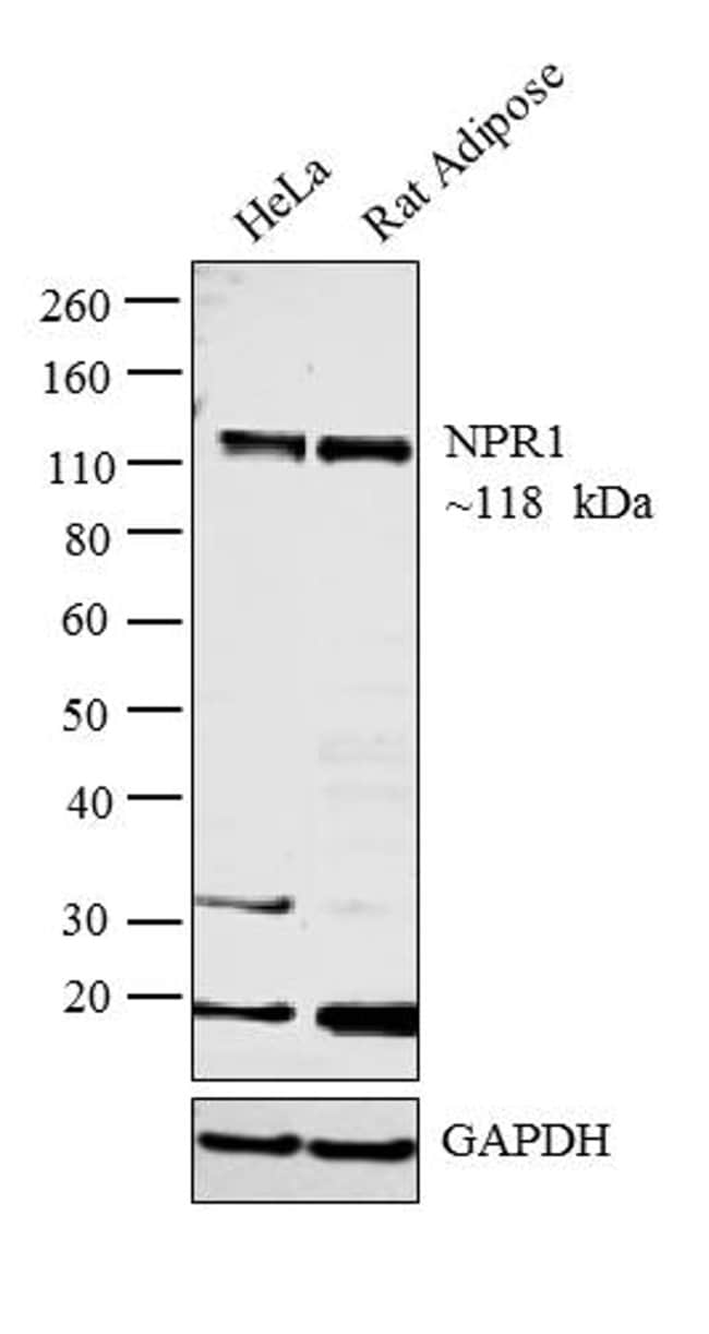 Anti-NPR-A