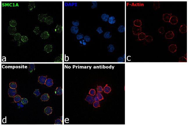 Anti-SMC1A