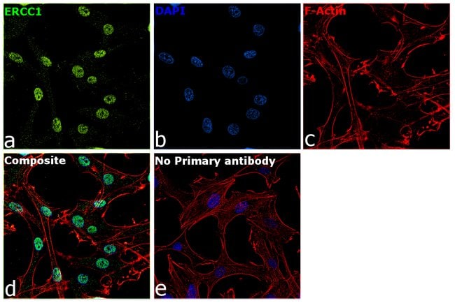 Anti-ERCC1