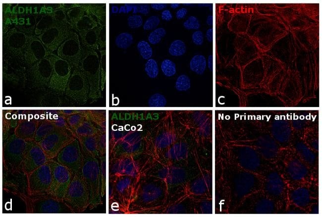 Anti-ALDH1A3