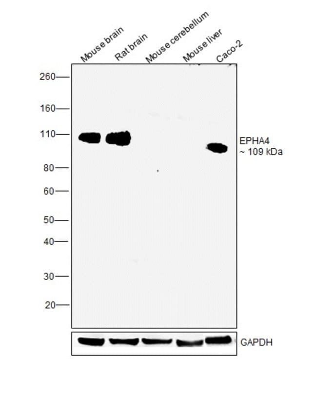 Anti-Eph receptor A4