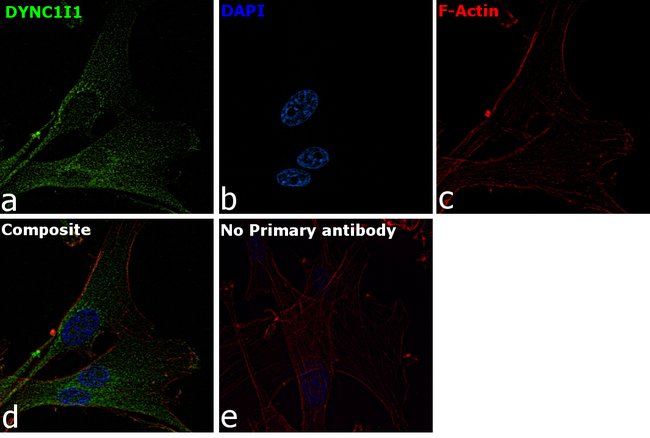 Anti-DYNC1I1