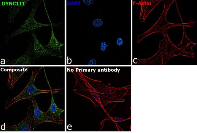 Anti-DYNC1I1