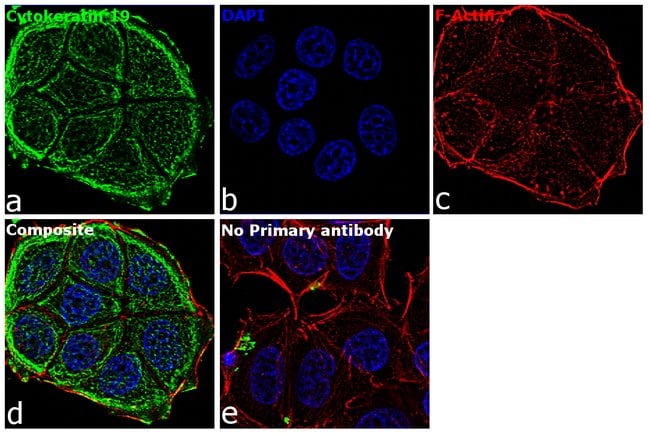Anti-Cytokeratin 19