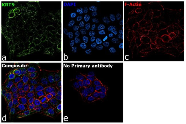 Anti-Cytokeratin 5