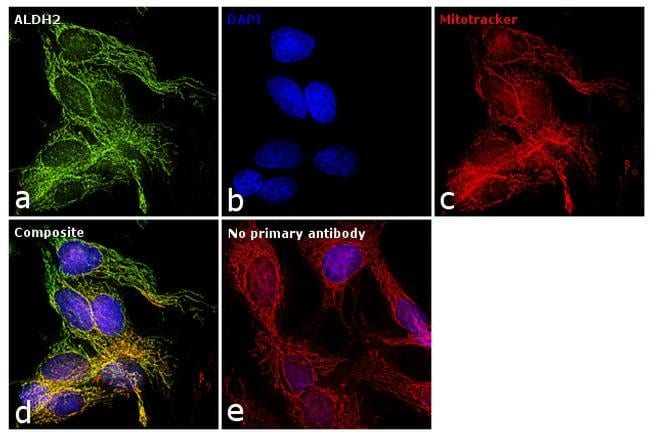 Anti-ALDH2