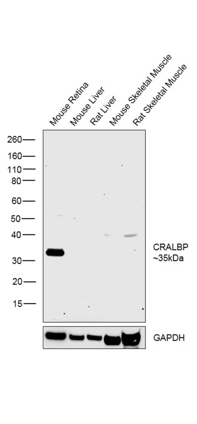Anti-CRALBP