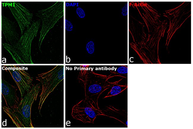 Anti-Tropomyosin 1