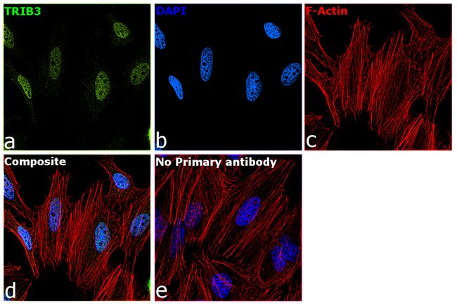 Anti-TRIB3