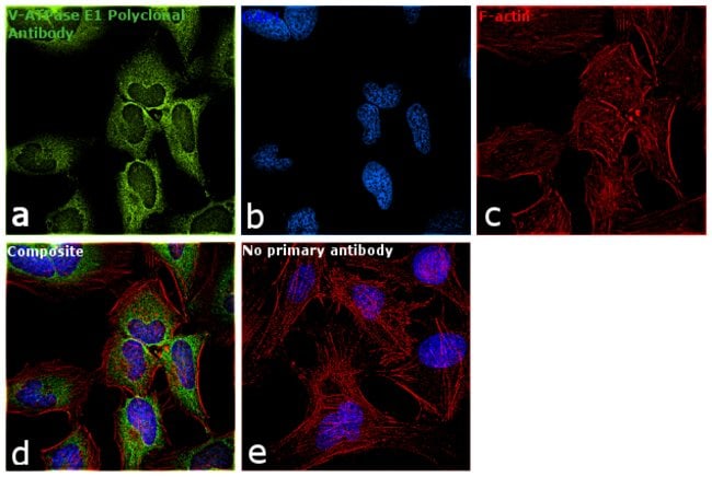 Anti-ATP6V1E1
