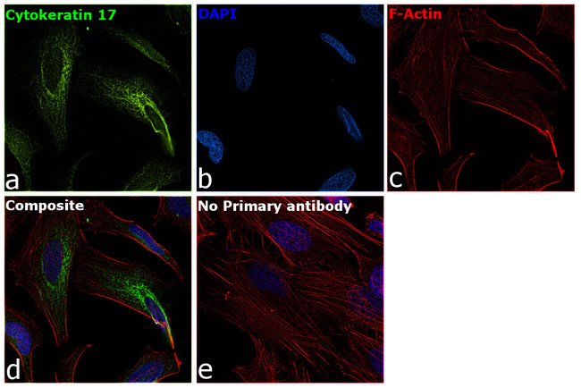 Anti-Cytokeratin 17