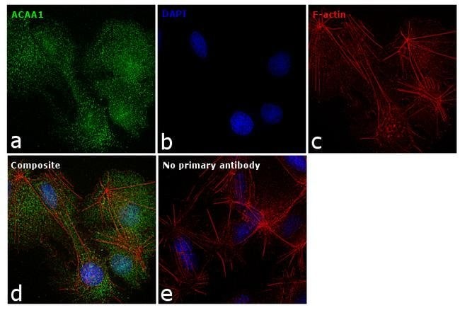 Anti-ACAA1