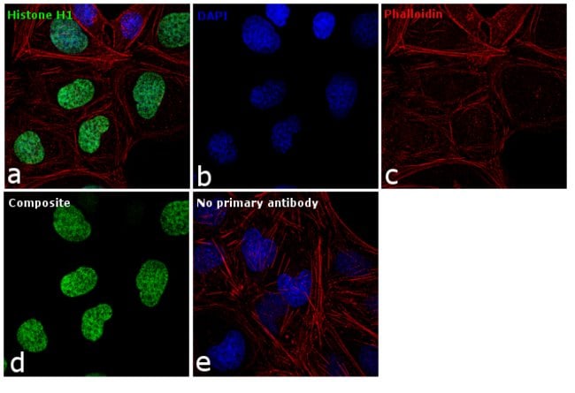 Anti-Histone H1