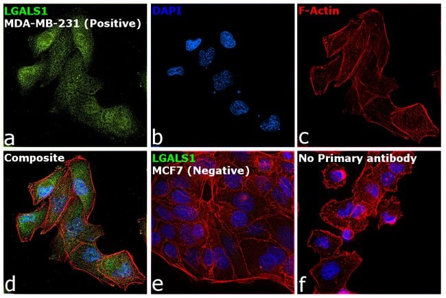 Anti-Galectin 1