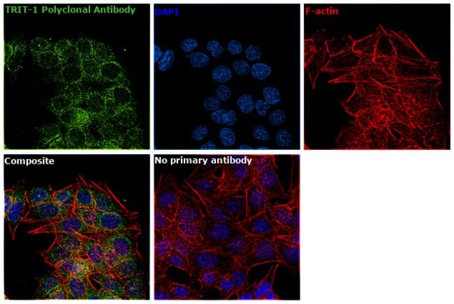 100uL Polyclonal antibody, triT1, host r