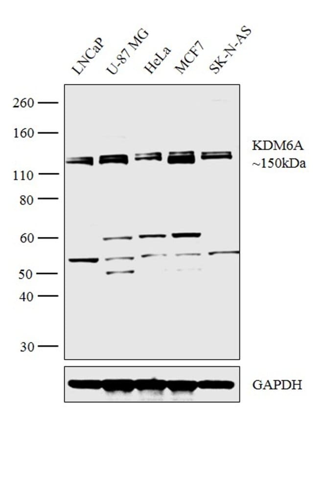 100uL Polyclonal antibody, KDM6A, host r