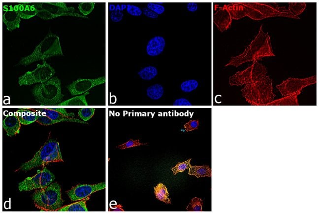 100uL Polyclonal antibody, S100A6, host