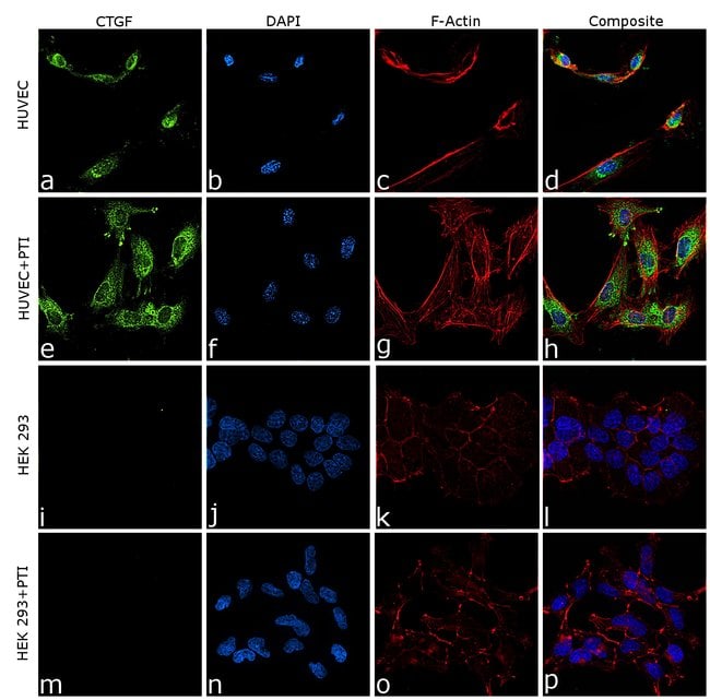 100uL Polyclonal antibody, CTGF, host ra